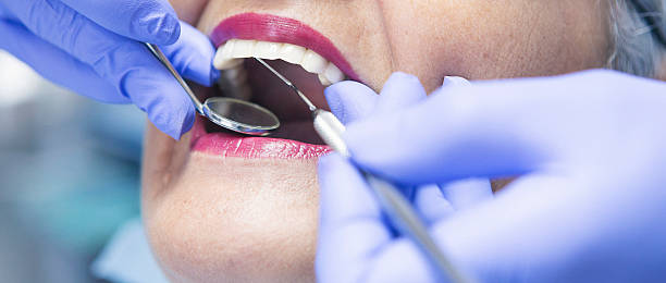 Best Emergency Dentist for Knocked-Out Tooth in Crown Heights, NY